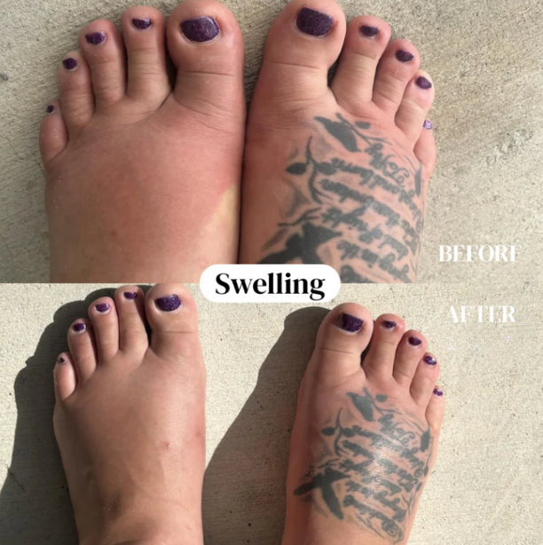 Lymphatic Drainage at 10% The Cost